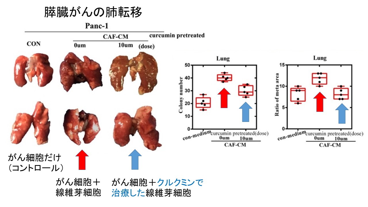 膵臓がん肺転移モデル　クルクミンによる転移抑制
